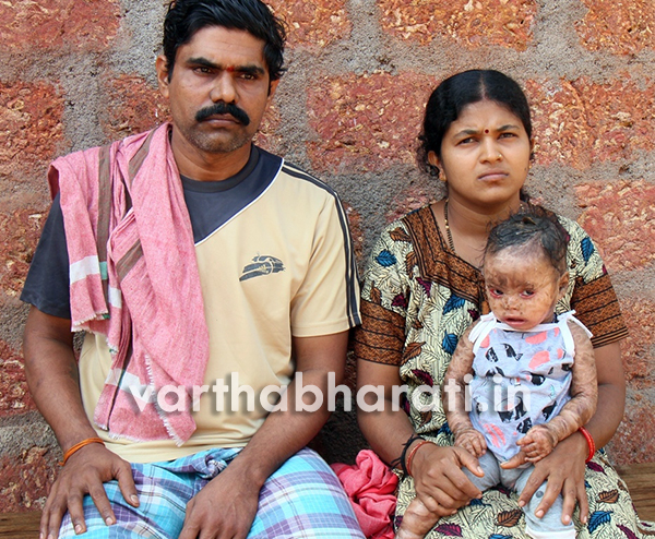 ಲಾವಣ್ಯಳಿಗೆ ಬೇಕು ನೆರವಿನ ಆಸರೆ